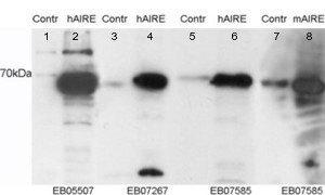 AIRE Antibody in Western Blot (WB)