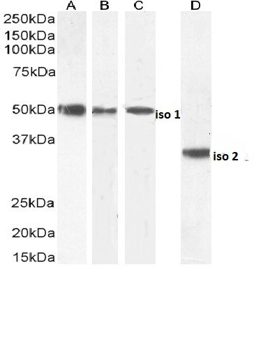 Chromogranin A Precursor Antibody in Western Blot (WB)