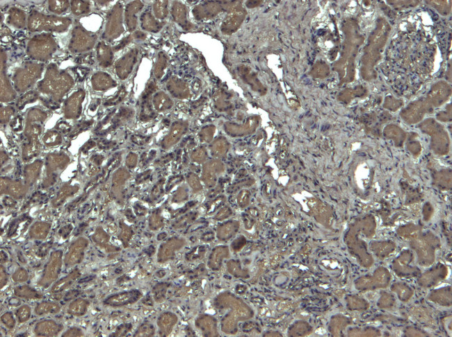 Catalase Antibody in Immunohistochemistry (Paraffin) (IHC (P))