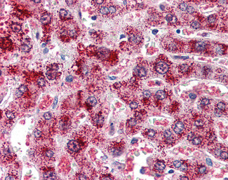 Catalase Antibody in Immunohistochemistry (Paraffin) (IHC (P))