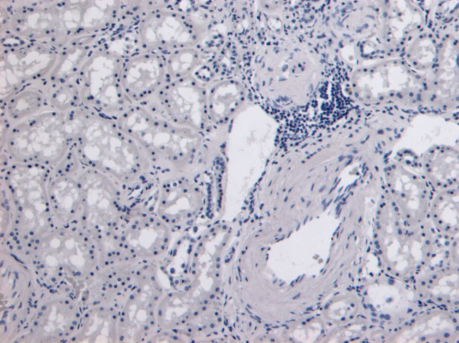 Catalase Antibody in Immunohistochemistry (Paraffin) (IHC (P))