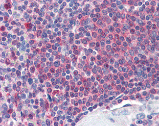 Catalase Antibody in Immunohistochemistry (Paraffin) (IHC (P))