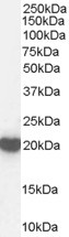 PRDX2 Antibody in Western Blot (WB)