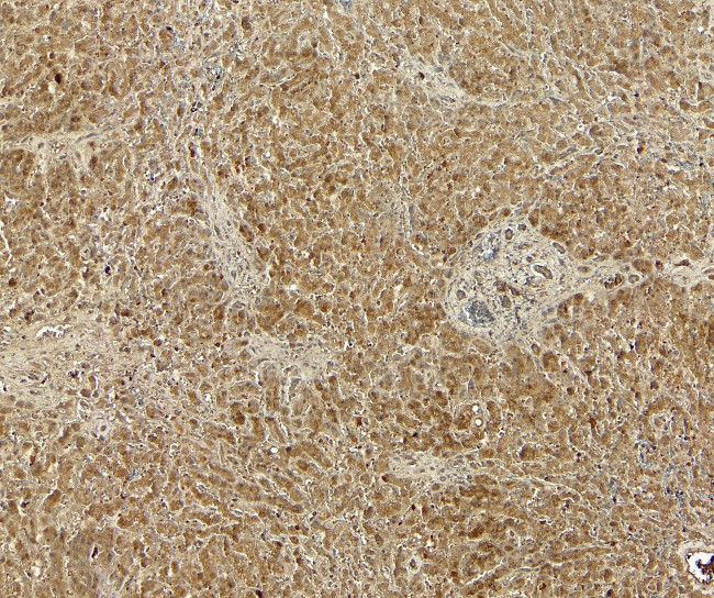 GRP94 Antibody in Immunohistochemistry (Paraffin) (IHC (P))