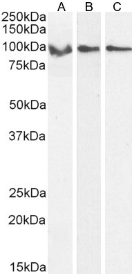 GRP94 Antibody in Western Blot (WB)