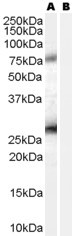 RCAS1 Antibody in Western Blot (WB)