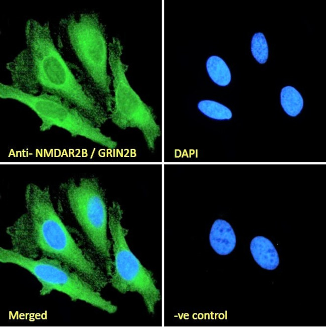 NMDAR2B Antibody in Immunocytochemistry (ICC/IF)