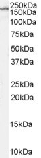 NMDAR2B Antibody in Western Blot (WB)