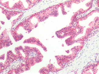 HSC70 Antibody in Immunohistochemistry (Paraffin) (IHC (P))