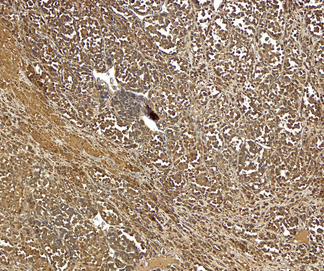 PMEL Antibody in Immunohistochemistry (Paraffin) (IHC (P))