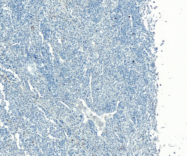 PMEL Antibody in Immunohistochemistry (Paraffin) (IHC (P))