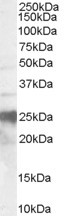 PrP Antibody in Western Blot (WB)