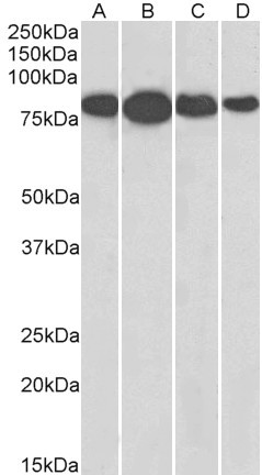 Radixin Antibody in Western Blot (WB)