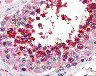 GPX4 Antibody in Immunohistochemistry (Paraffin) (IHC (P))