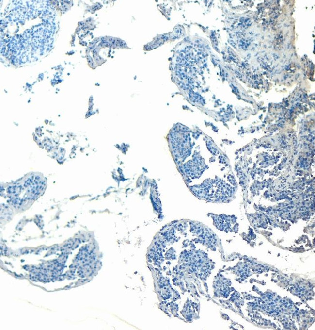 GPX4 Antibody in Immunohistochemistry (Paraffin) (IHC (P))