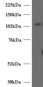 Munc13-4 Antibody in Western Blot (WB)