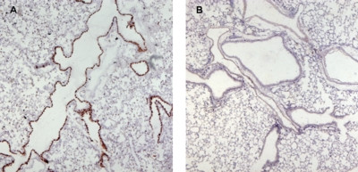 Munc13-4 Antibody in Immunohistochemistry (Paraffin) (IHC (P))