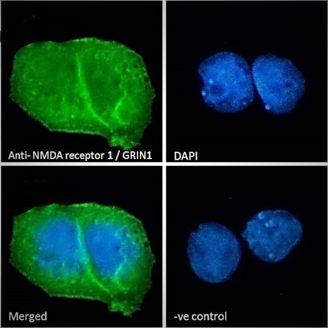 NMDAR1 Antibody in Immunocytochemistry (ICC/IF)