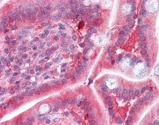 COMT Antibody in Immunohistochemistry (Paraffin) (IHC (P))