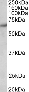 PAK1 Antibody in Western Blot (WB)