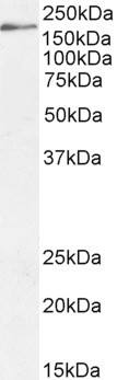 DSCAM Antibody in Western Blot (WB)