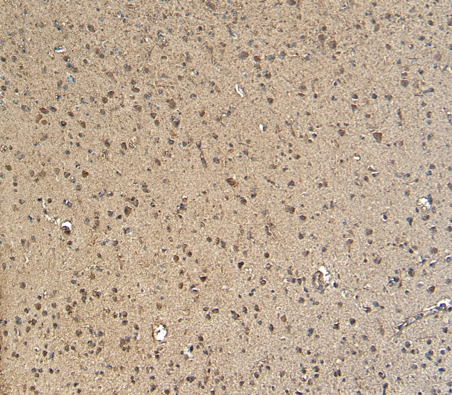 GBX2 Antibody in Immunohistochemistry (Paraffin) (IHC (P))