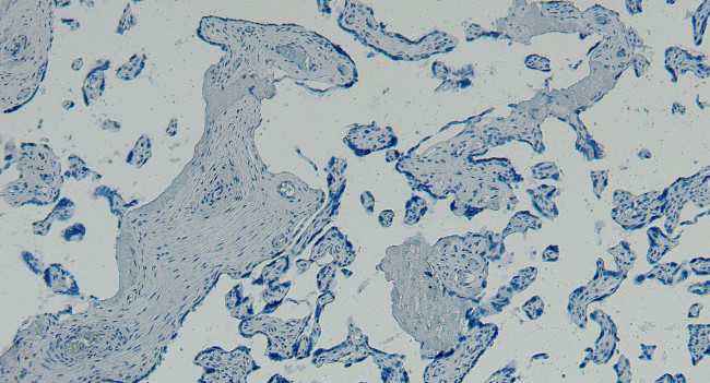 GBX2 Antibody in Immunohistochemistry (Paraffin) (IHC (P))