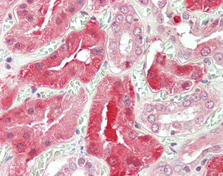 STAT3 Antibody in Immunohistochemistry (Paraffin) (IHC (P))