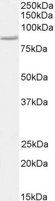 STAT3 Antibody in Western Blot (WB)