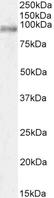 STAT3 Antibody in Western Blot (WB)