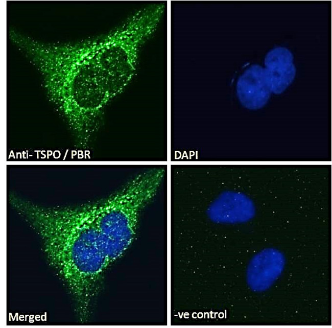 TSPO Antibody in Immunocytochemistry (ICC/IF)