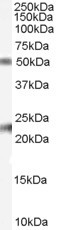 Fibulin 5 Antibody in Western Blot (WB)