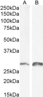 SNAIL Antibody in Western Blot (WB)