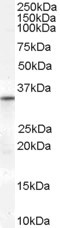 VDAC2 Antibody in Western Blot (WB)