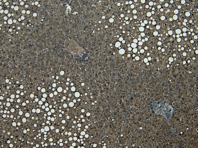 CPT1A Antibody in Immunohistochemistry (Paraffin) (IHC (P))