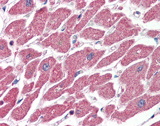 CPT1A Antibody in Immunohistochemistry (Paraffin) (IHC (P))