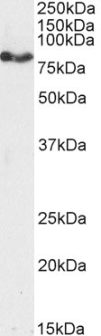 CPT1A Antibody in Western Blot (WB)