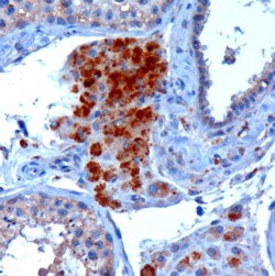 SBP2 Antibody in Immunohistochemistry (Paraffin) (IHC (P))