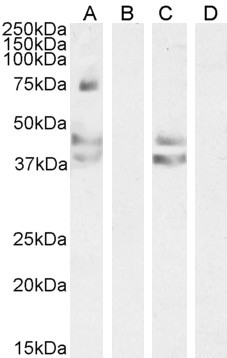 AGTR1 Antibody in Western Blot (WB)