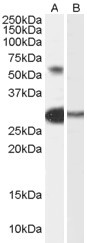 TCFL5 Antibody in Western Blot (WB)