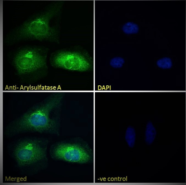 Arylsulfatase A Antibody in Immunocytochemistry (ICC/IF)
