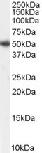 PICK1 Antibody in Western Blot (WB)