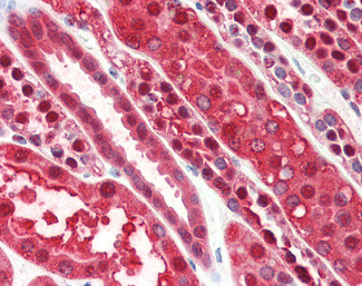 PEBP1 Antibody in Immunohistochemistry (Paraffin) (IHC (P))