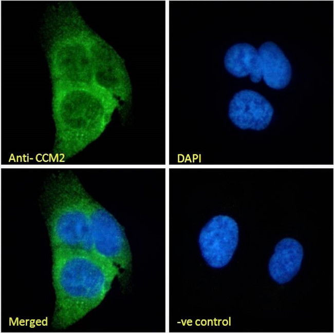 CCM2 Antibody in Immunocytochemistry (ICC/IF)