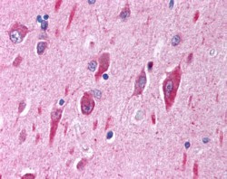 PIK3CA Antibody in Immunohistochemistry (Paraffin) (IHC (P))