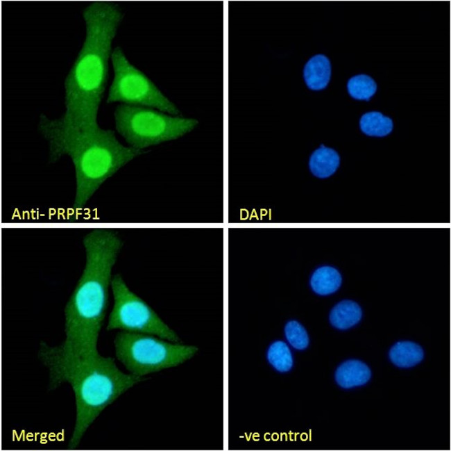 PRPF31 Antibody in Immunocytochemistry (ICC/IF)