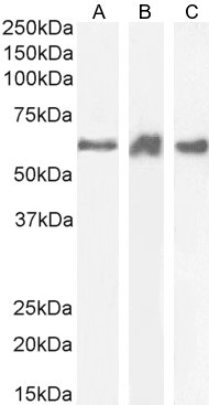 PRPF31 Antibody in Western Blot (WB)