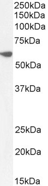 PRPF31 Antibody in Western Blot (WB)