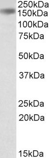 Drosha Antibody in Western Blot (WB)