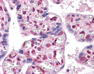 FOXP2 Antibody in Immunohistochemistry (Paraffin) (IHC (P))